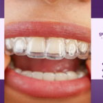 Is Invisalign Worth It in Guildford? Cost & Results