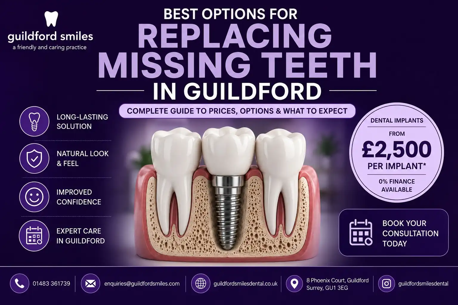best-options-for-replacing-missing-teeth-guildford