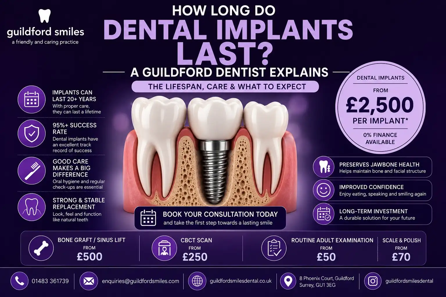how-long-do-dental-implants-last-guildford