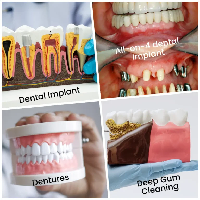 Specialist dentistry, dental implants and restorative treatments for patients from Godalming at Guildford Smiles Dental.